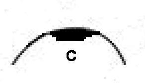 colon button colon button